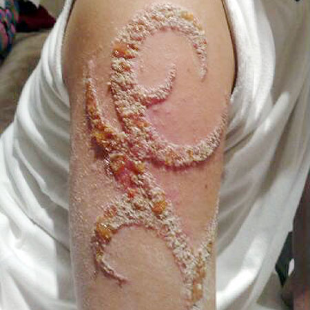  Remove Henna Tattoos on Allergie Tattoo   Lilz Eu   Tattoo De