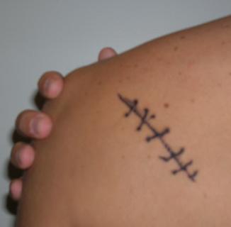 tatouage de fan de mylene farmer cicatrice